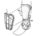 Shin guard featuring a protective shell (1) clipped onto a padded gaiter (2) (DE 297 05 759 U1).